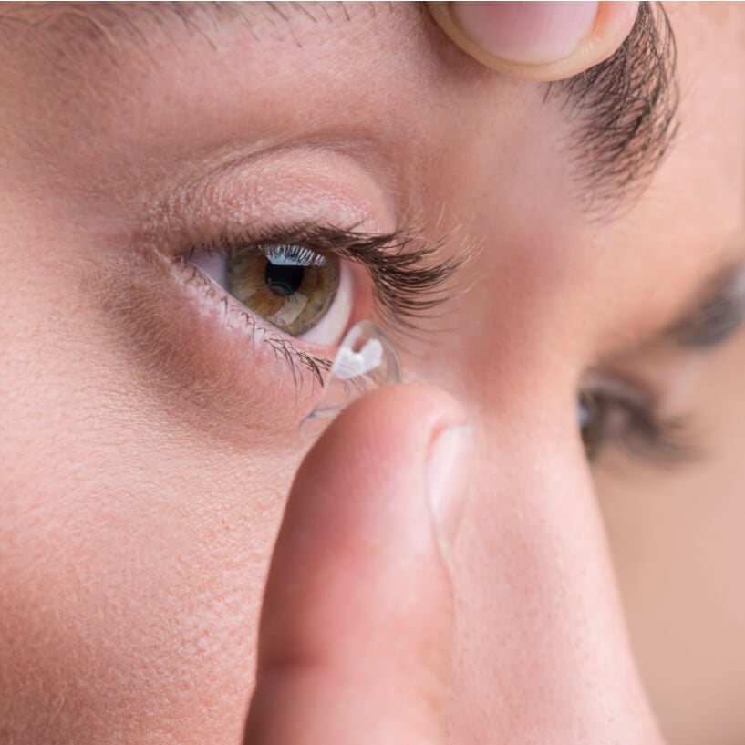 Women removes contact lens before laser eye surgery