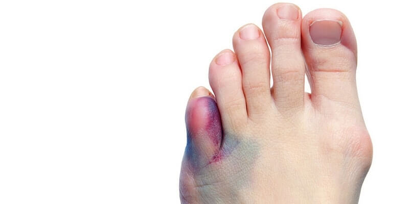 high heels bad for feet