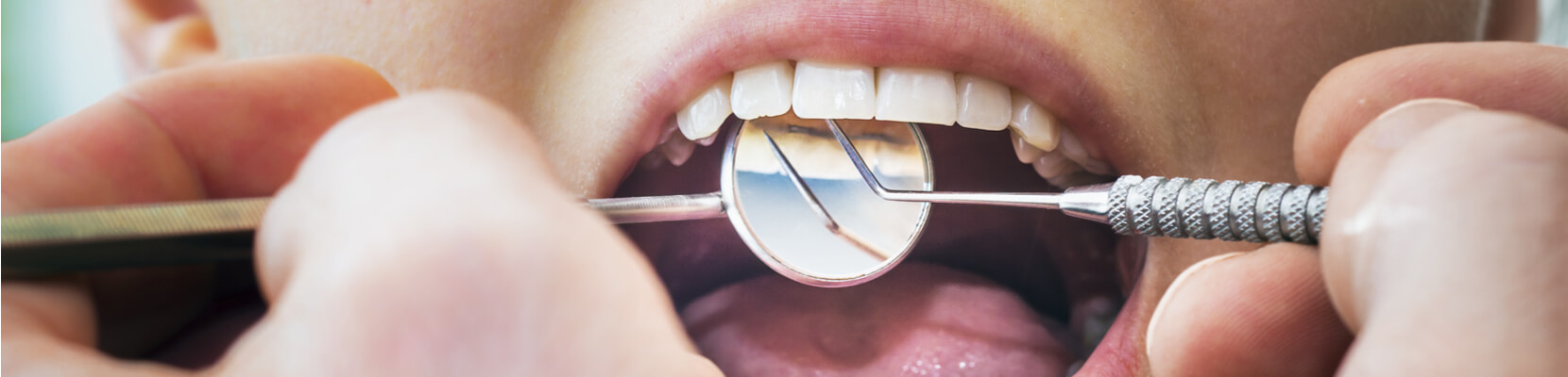 close up of dentist performing examination on female patient