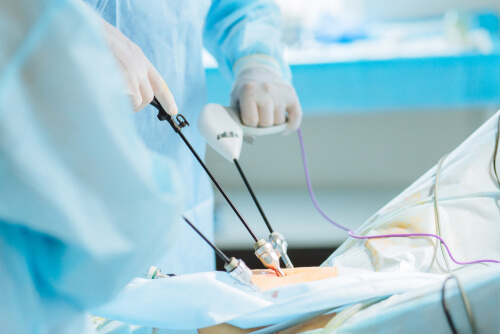 a surgeon performing a laparoscopy