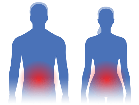 A heat map diagram demonstrating abdominal and pelvic pain