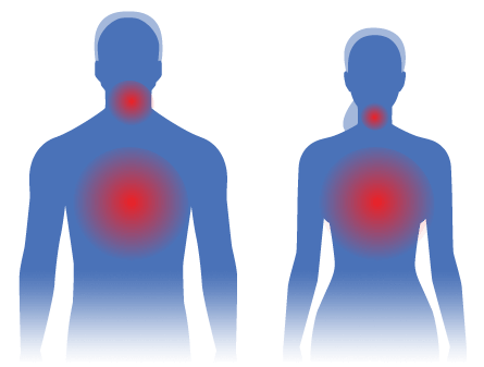 A heat map diagram demonstrating pain in throat and chest